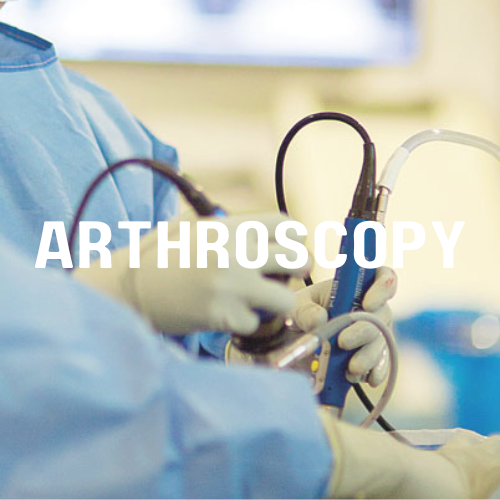 Arthroscopy
